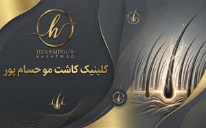 کلینیک کاشت مو حسام پور