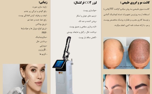 کلینیک کاشت مو پریسان